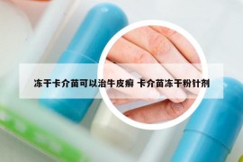 冻干卡介苗可以治牛皮癣 卡介苗冻干粉针剂