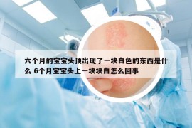 六个月的宝宝头顶出现了一块白色的东西是什么 6个月宝宝头上一块块白怎么回事