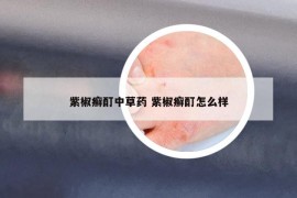 紫椒癣酊中草药 紫椒癣酊怎么样