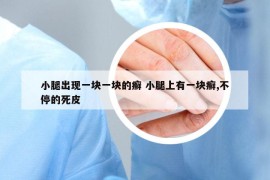 小腿出现一块一块的癣 小腿上有一块癣,不停的死皮