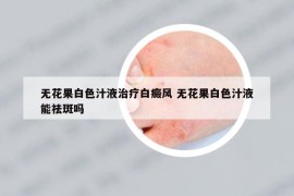 无花果白色汁液治疗白癜风 无花果白色汁液能祛斑吗