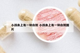 小孩身上有一块白斑 小孩身上有一块白斑图片