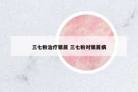 三七粉治疗银屑 三七粉对银屑病