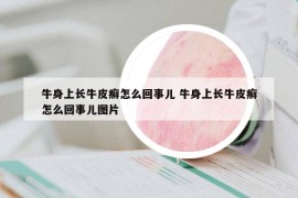 牛身上长牛皮癣怎么回事儿 牛身上长牛皮癣怎么回事儿图片