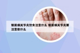 银屑病关节炎饮食注意什么 银屑病关节炎要注意些什么