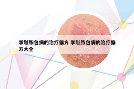 掌趾脓包病的治疗偏方 掌趾脓包病的治疗偏方大全