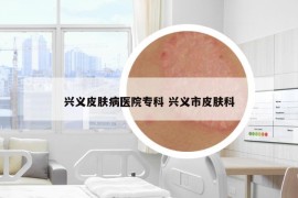 兴义皮肤病医院专科 兴义市皮肤科