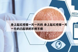 身上起红疙瘩一片一片的 身上起红疙瘩一片一片的凸起状的不疼不痒