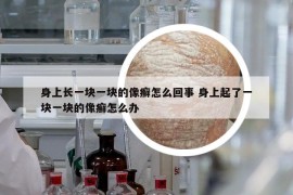 身上长一块一块的像癣怎么回事 身上起了一块一块的像癣怎么办