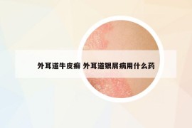 外耳道牛皮癣 外耳道银屑病用什么药