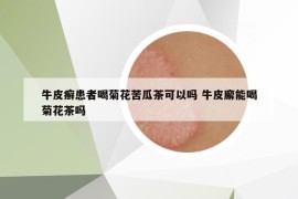 牛皮癣患者喝菊花苦瓜茶可以吗 牛皮廨能喝菊花茶吗