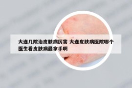 大连几院治皮肤病厉害 大连皮肤病医院哪个医生看皮肤病最拿手啊