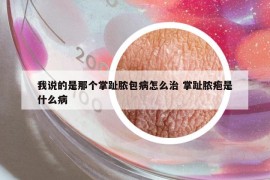 我说的是那个掌趾脓包病怎么治 掌趾脓疱是什么病