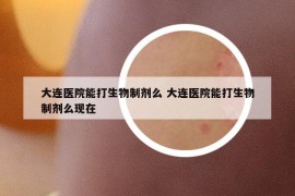 大连医院能打生物制剂么 大连医院能打生物制剂么现在