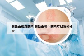 楚雄白癜风医院 楚雄市哪个医院可以激光祛斑
