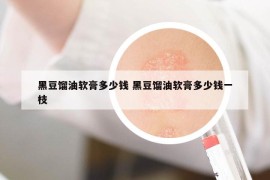 黑豆馏油软膏多少钱 黑豆馏油软膏多少钱一枝