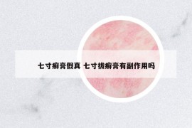 七寸癣膏假真 七寸拔癣膏有副作用吗