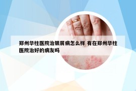 郑州华柱医院治银屑病怎么样 有在郑州华柱医院治好的病友吗