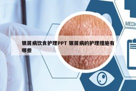 银屑病饮食护理PPT 银屑病的护理措施有哪些