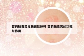 苗药肤毒灵皮肤破能抹吗 苗药肤毒灵的功效与作用
