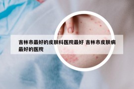 吉林市最好的皮肤科医院最好 吉林市皮肤病最好的医院