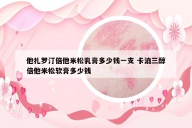 他扎罗汀倍他米松乳膏多少钱一支 卡泊三醇倍他米松软膏多少钱