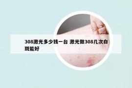 308激光多少钱一台 激光做308几次白斑能好