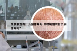 生物制剂有什么副作用吗 生物制剂有什么副作用吗?