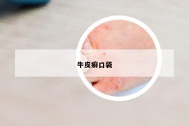 牛皮癣口袋