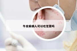牛皮癣病人可以吃苋菜吗