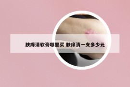 肤痒清软膏哪里买 肤痒清一支多少元