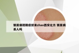 银屑病初期症状来zhao西安北方 银屑病丢人吗