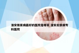 淮安银屑病最好的医院是哪家 淮安皮肤病专科医院