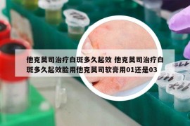 他克莫司治疗白斑多久起效 他克莫司治疗白斑多久起效脸用他克莫司软膏用01还是03