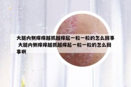 大腿内侧痒痒越抓越痒起一粒一粒的怎么回事 大腿内侧痒痒越抓越痒起一粒一粒的怎么回事啊