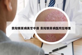 贵阳银屑病美誉中康 贵阳银屑病医院在哪里