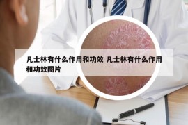 凡士林有什么作用和功效 凡士林有什么作用和功效图片