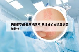 天津好的治银屑病医院 天津好的治银屑病医院排名