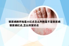银屑病刚开始是小红点怎么判断是不是银屑病 银屑病红点,怎么样算好点