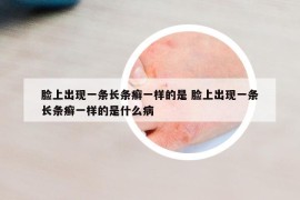 脸上出现一条长条癣一样的是 脸上出现一条长条癣一样的是什么病