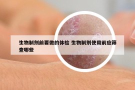 生物制剂前要做的体检 生物制剂使用前应筛查哪些