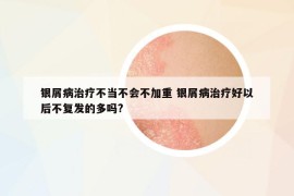 银屑病治疗不当不会不加重 银屑病治疗好以后不复发的多吗?