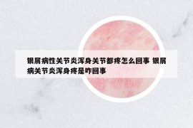 银屑病性关节炎浑身关节都疼怎么回事 银屑病关节炎浑身疼是咋回事