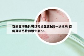 百癣夏塔热片可以和维生素b族一块吃吗 百癣夏塔热片和维生素b6