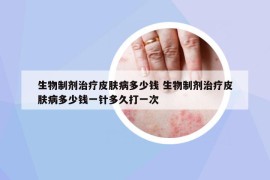 生物制剂治疗皮肤病多少钱 生物制剂治疗皮肤病多少钱一针多久打一次