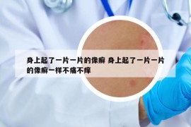 身上起了一片一片的像癣 身上起了一片一片的像癣一样不痛不痒
