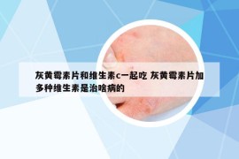 灰黄霉素片和维生素c一起吃 灰黄霉素片加多种维生素是治啥病的