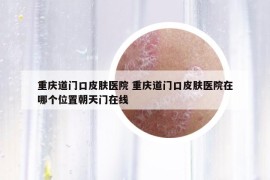 重庆道门口皮肤医院 重庆道门口皮肤医院在哪个位置朝天门在线