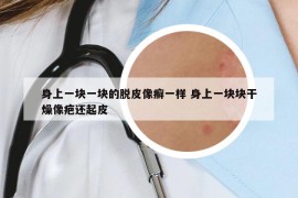 身上一块一块的脱皮像癣一样 身上一块块干燥像疤还起皮