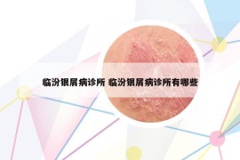 临汾银屑病诊所 临汾银屑病诊所有哪些